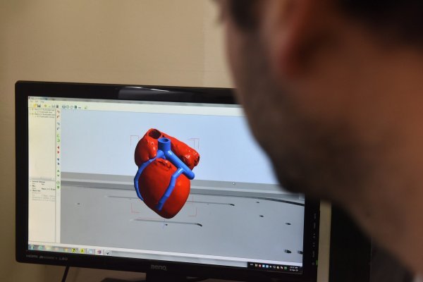 3D srce