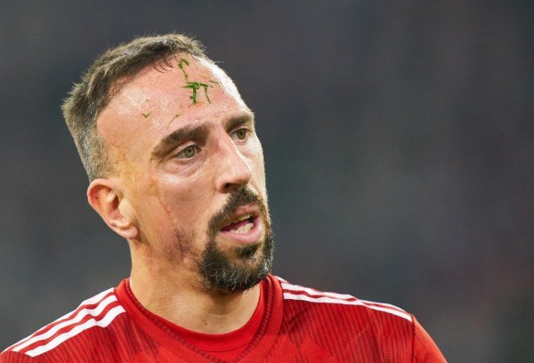 Franck Ribery zaradio je ožiljak na licu kao dvogodišnjak u prometnoj nesreći